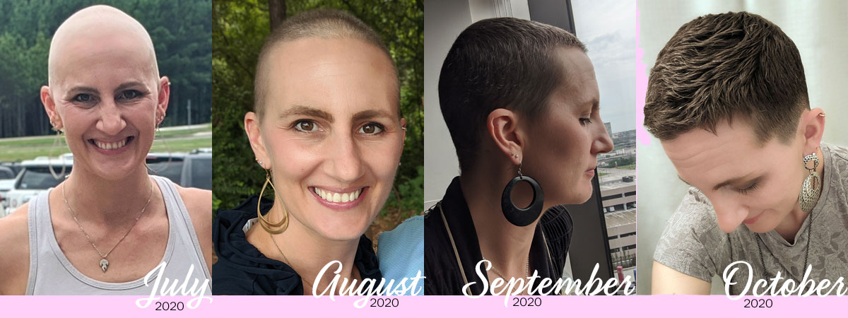 Top Image Hair Growth After Chemo Thptnganamst Edu Vn